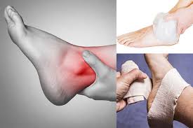 Phương pháp trị bong gân hiệu quả