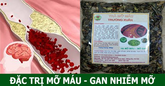 Trà Mỡ Máu - Điều trị Mỡ máu cao, Gan nhiễm mỡ
